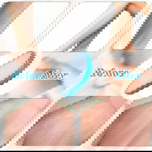Depiladora de Cristal Mágica EPILATOR - PRICENTER - 